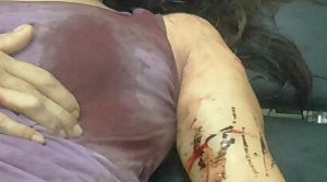 Korban bernama Yetty Srihajar Riawati dengan luka tusukan. Foto istimewa
